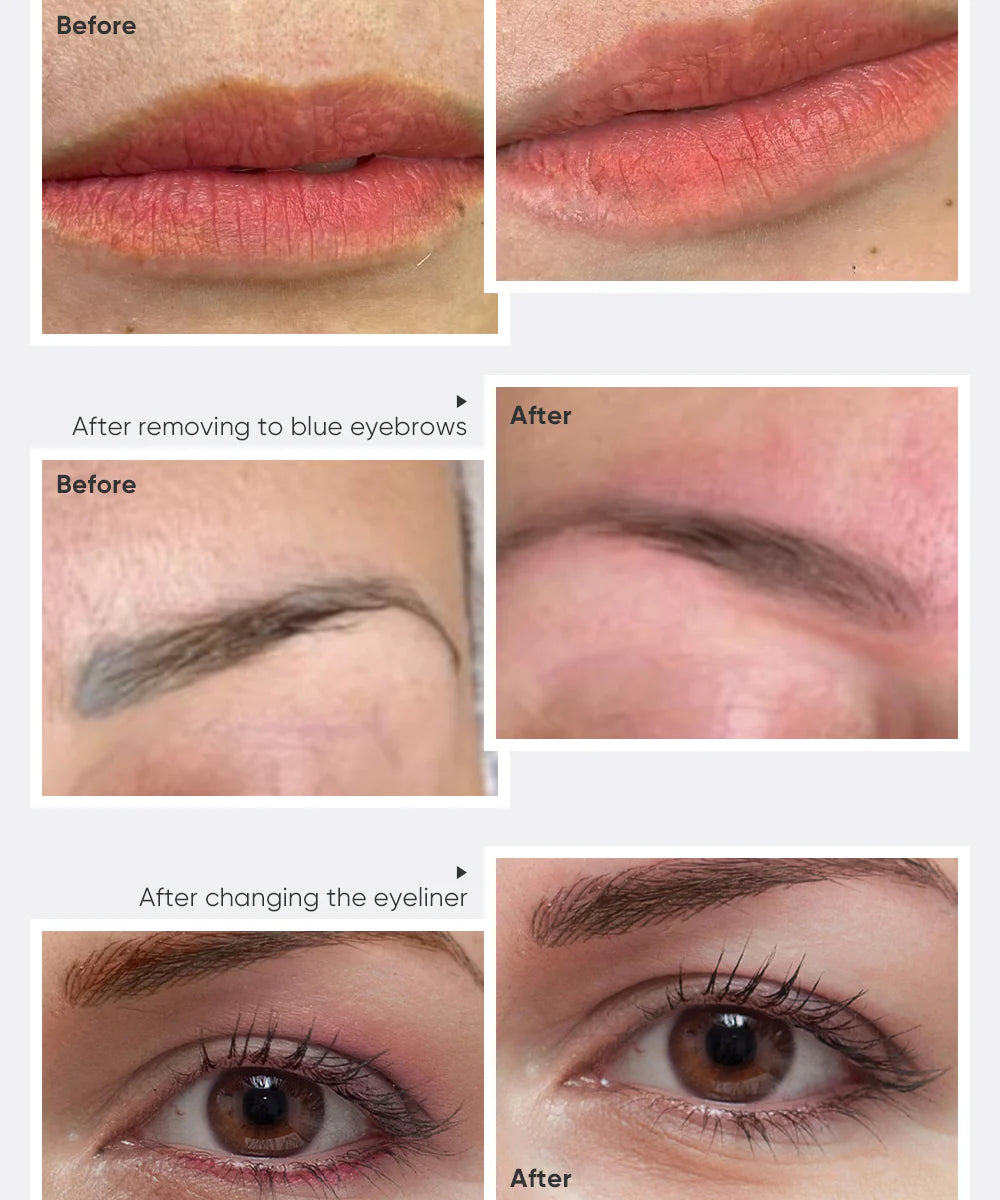 BIOMASER Removal Solution | Remover